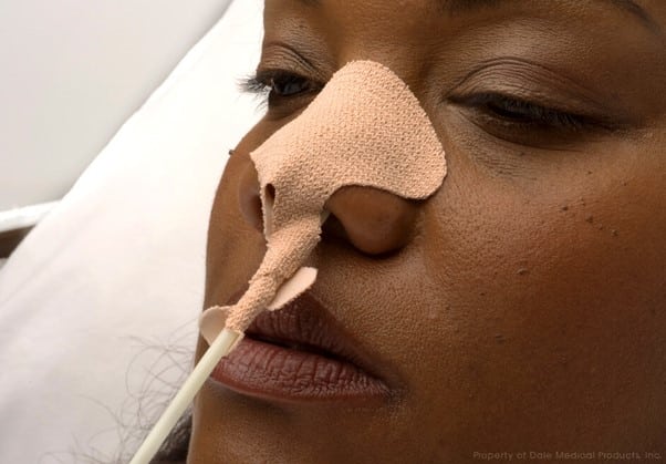 Nasogastric Tube Holder (160)